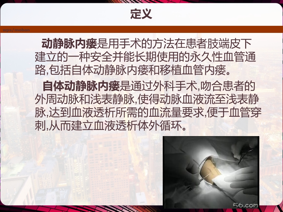 动静脉内瘘的穿刺与护理课件.pptx_第3页