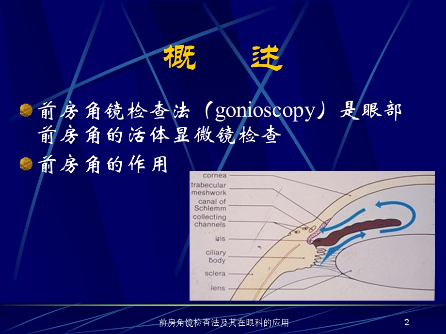 前房角镜检查法及其在眼科的应用课件.ppt_第2页