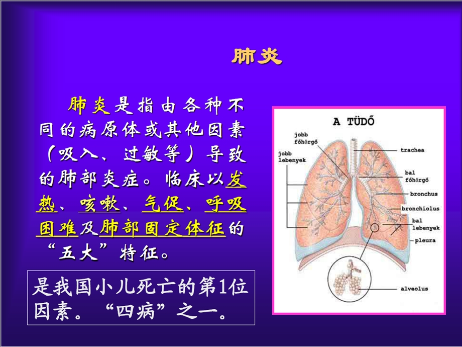 儿科护理课件肺炎.ppt_第2页