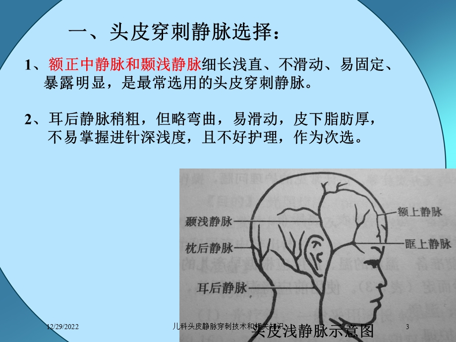 儿科头皮静脉穿刺技术和相关知识课件.ppt_第3页