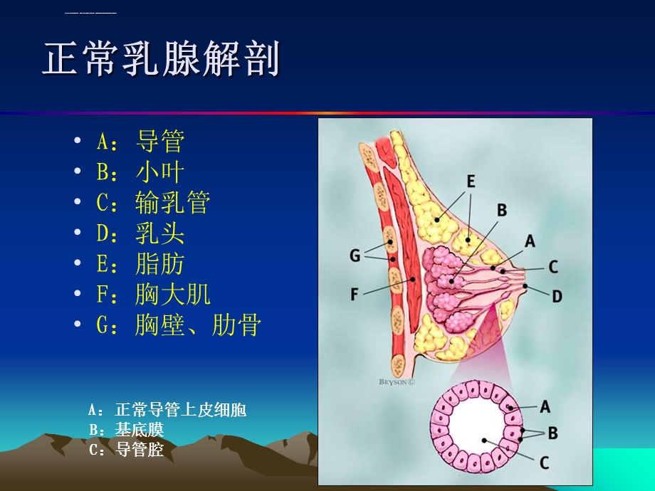 乳腺癌的超声诊断ppt课件.ppt_第3页