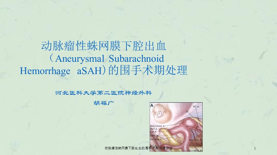 动脉瘤性蛛网膜下腔出血的围手术期处理讲座课件.ppt_第1页