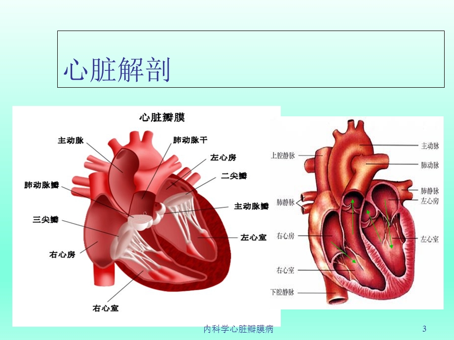 内科学心脏瓣膜病培训课件.ppt_第3页