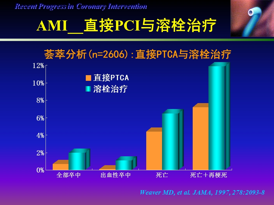 冠心病介入治疗展课件.ppt_第3页