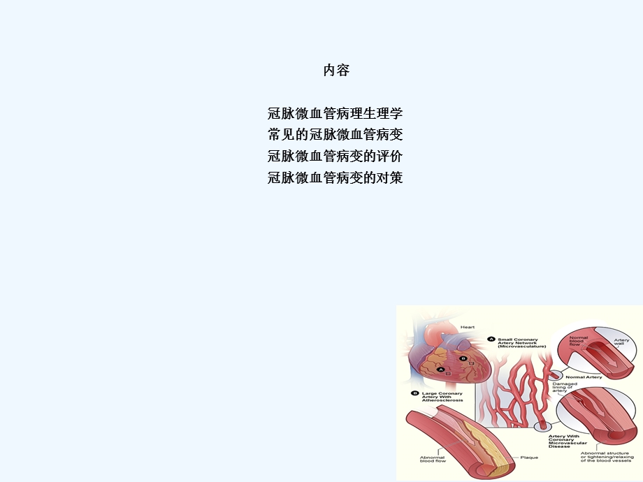 冠状动脉微血管病变与对策课件.ppt_第2页