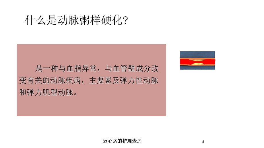 冠心病的护理查房培训课件.ppt_第3页