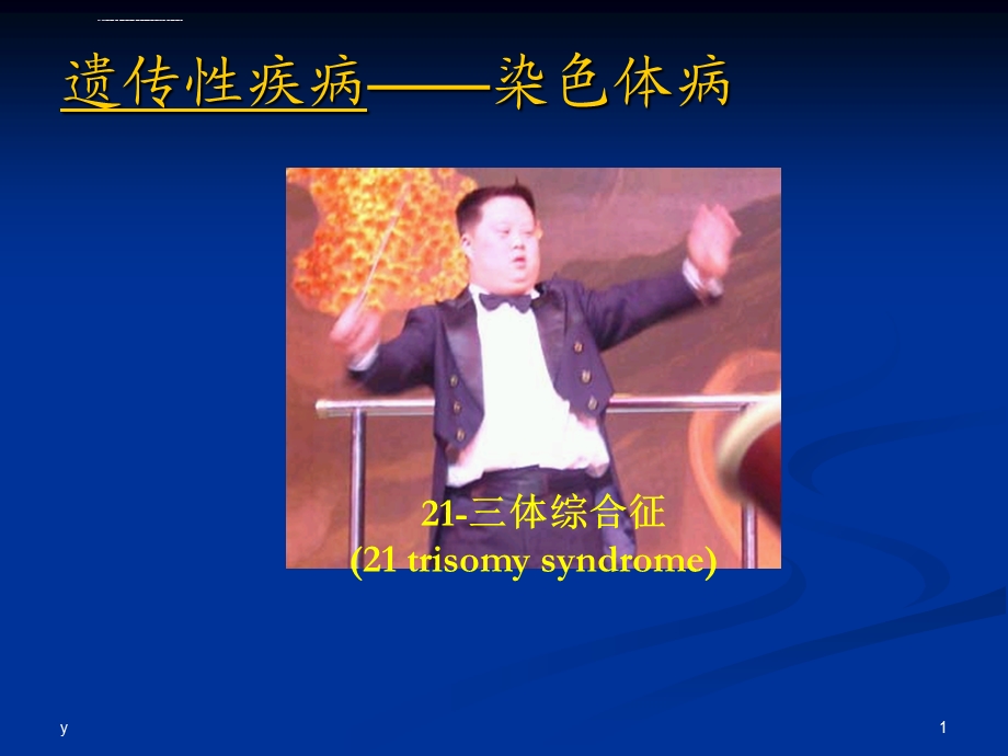 三体综合征PPT课件.ppt_第1页