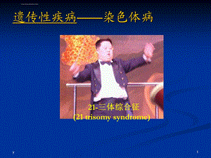 三体综合征PPT课件.ppt