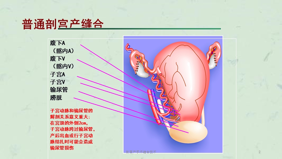 剖宫产手术缝合技术课件.ppt_第2页