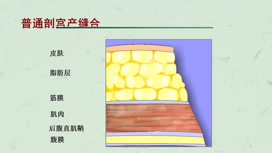 剖宫产手术缝合技术课件.ppt_第3页