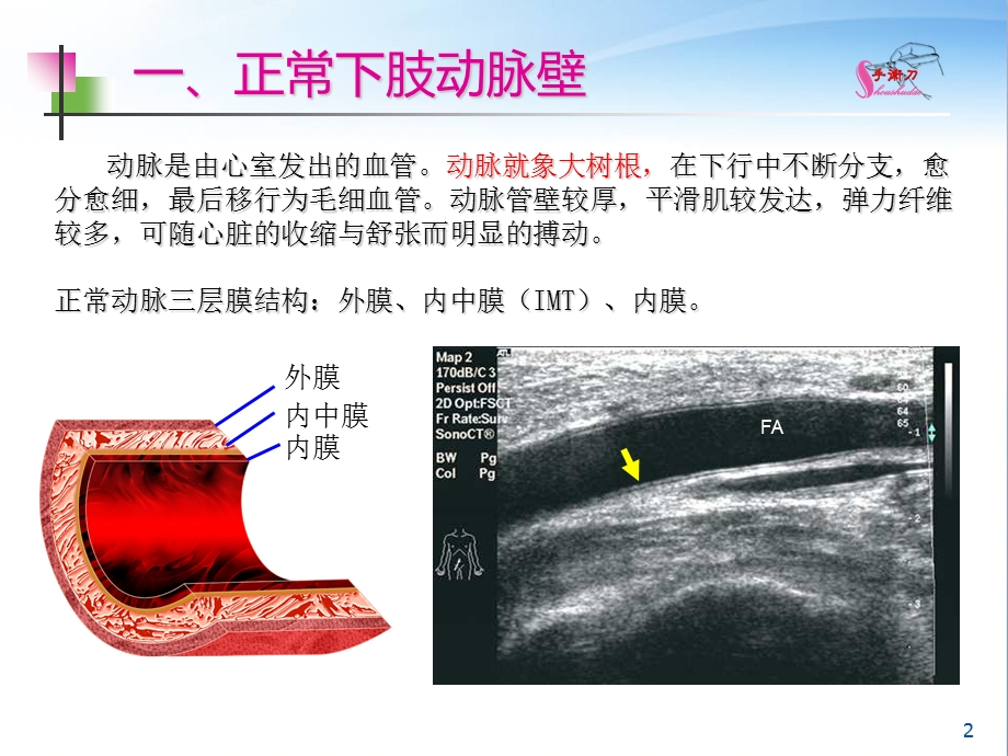 下肢血管的超声检查及正常声像图ppt课件.ppt_第2页