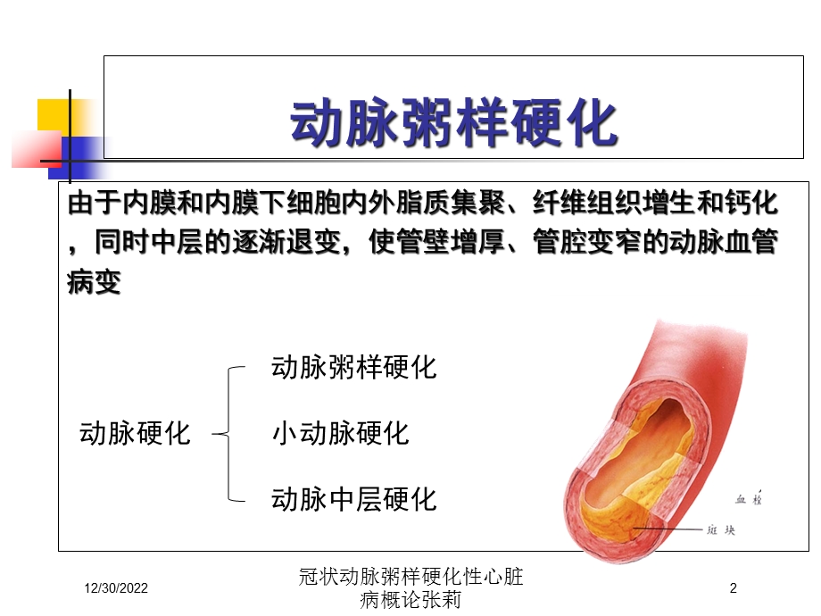 冠状动脉粥样硬化性心脏病概论培训课件.ppt_第2页