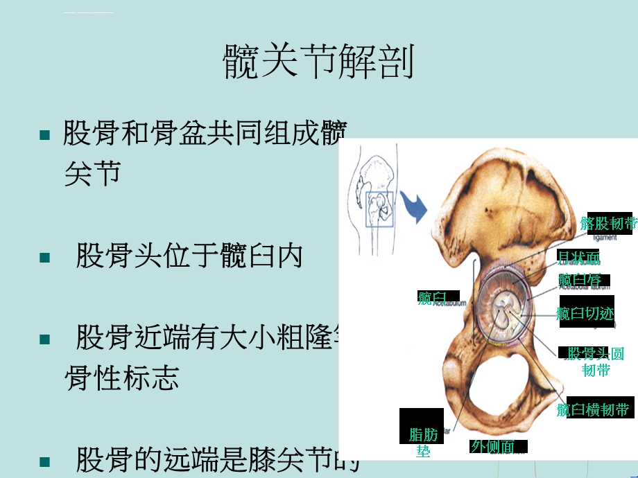 人工髋关节置换术的护理PPT课件.ppt_第3页