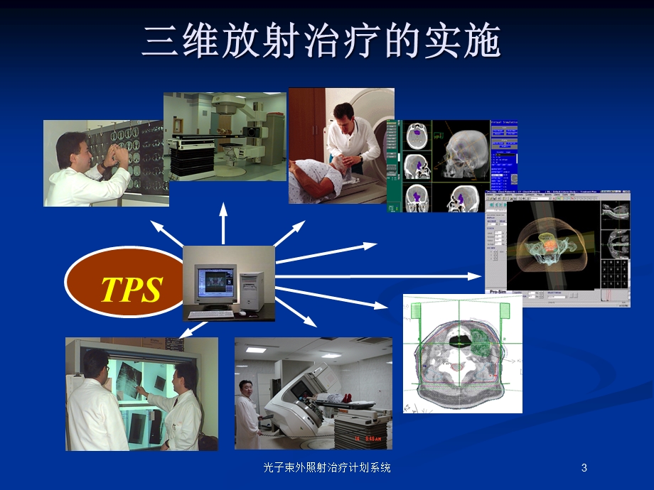 光子束外照射治疗计划系统培训课件.ppt_第3页