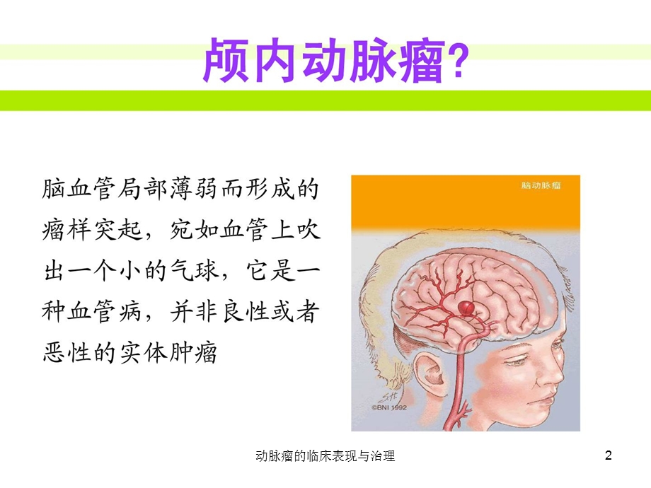 动脉瘤的临床表现与治理课件.ppt_第2页