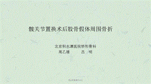 假体周围骨折中文课件.ppt