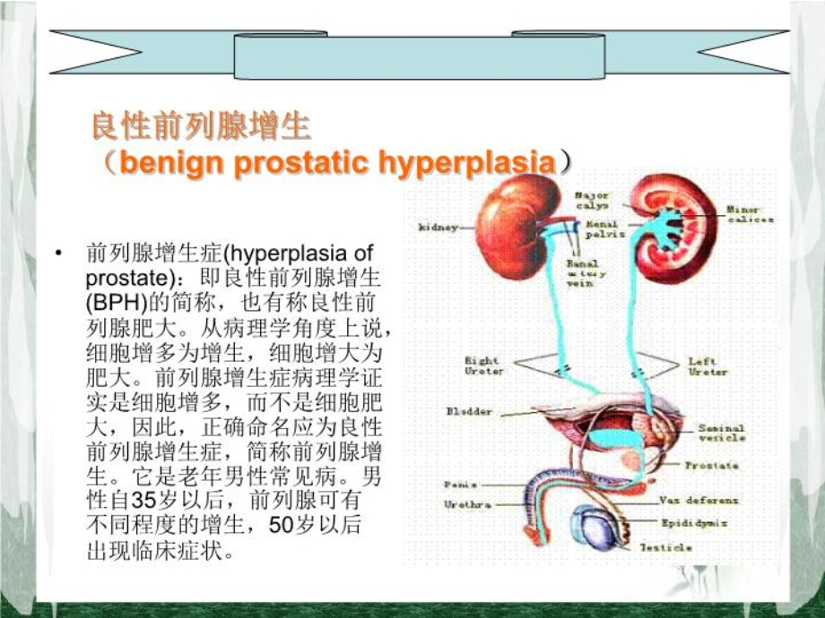 前列腺增生病人的护理课件.ppt_第3页