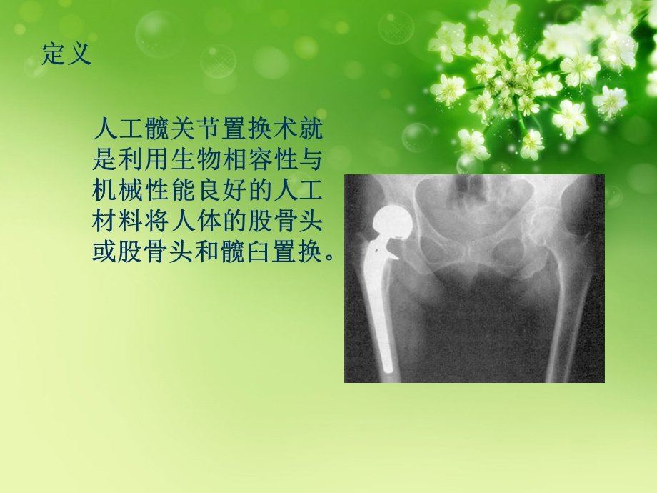 人工髋关节置换的护理ppt课件.ppt_第2页