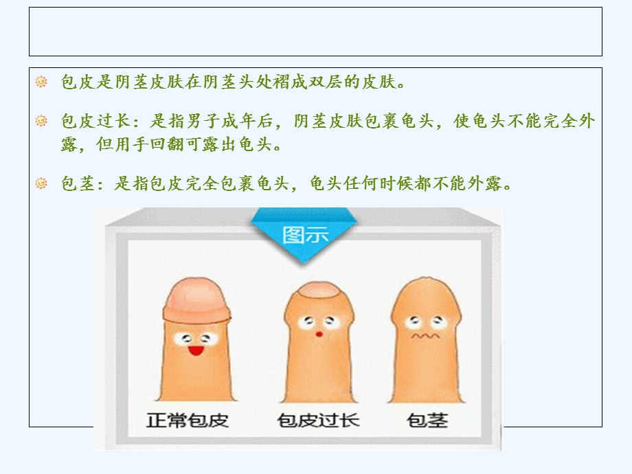 包茎包皮过长护理课件.ppt_第2页