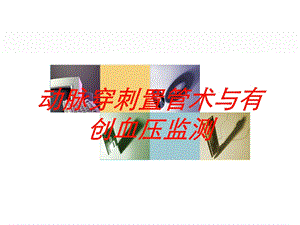 动脉穿刺置管术与有创血压监测培训课件.ppt