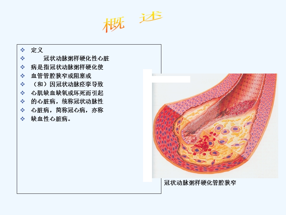 冠状动脉粥样硬化性心脏病人护理课件.ppt_第3页