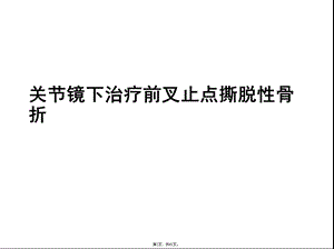 关节镜下治疗前叉止点撕脱性骨折(介绍：治疗)共61张课件.pptx