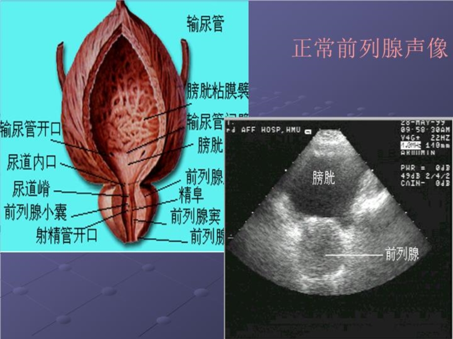 前列腺等超声诊断2021课件.ppt_第3页