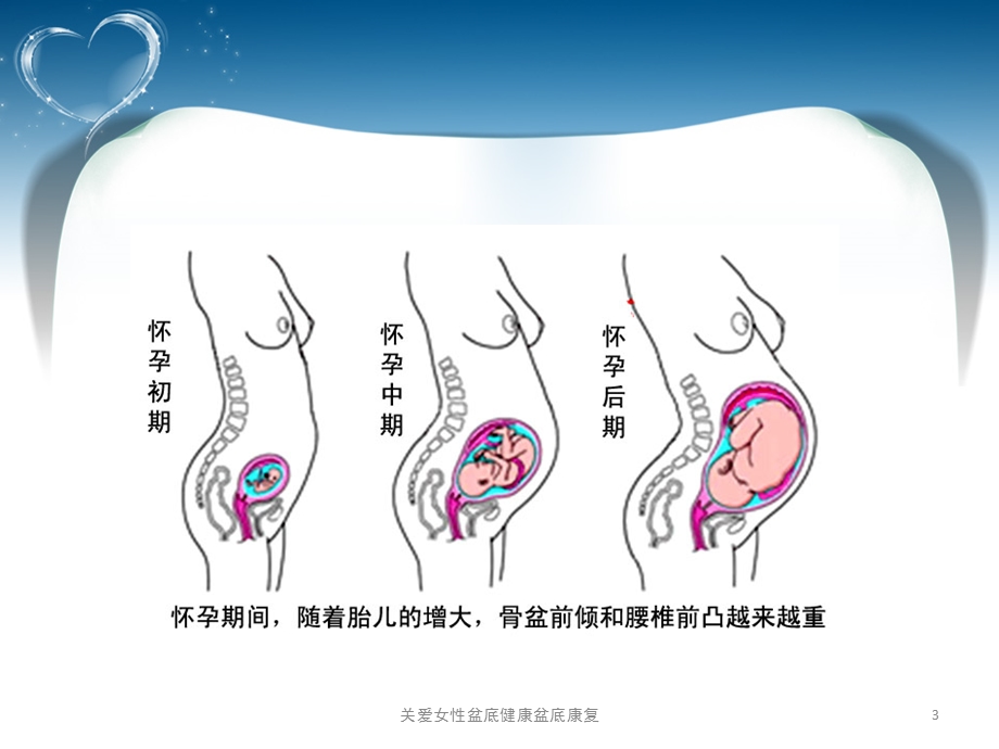 关爱女性盆底健康盆底康复课件.ppt_第3页