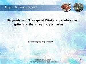 假性垂体瘤英文及病例课件.ppt