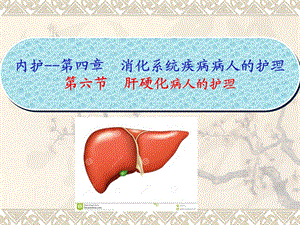 内护四六节肝硬化病人的护理课件.pptx