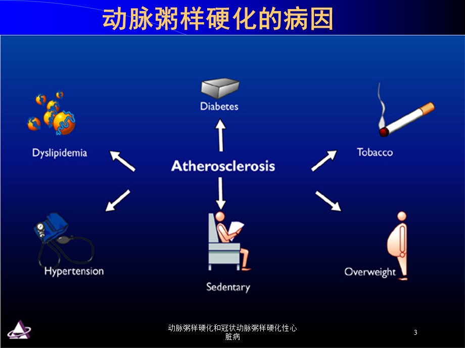 动脉粥样硬化和冠状动脉粥样硬化性心脏病培训课件.ppt_第3页