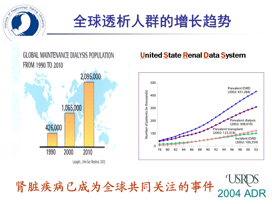 免疫抑制剂在肾脏病中的应用概要课件.ppt_第2页