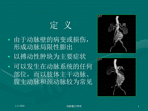 动脉瘤CT表现课件.ppt