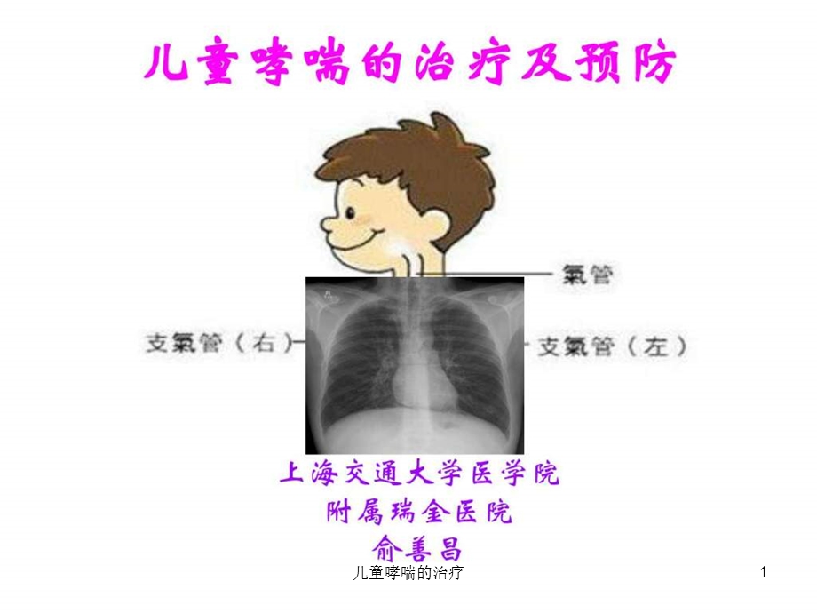 儿童哮喘的治疗课件.ppt_第1页