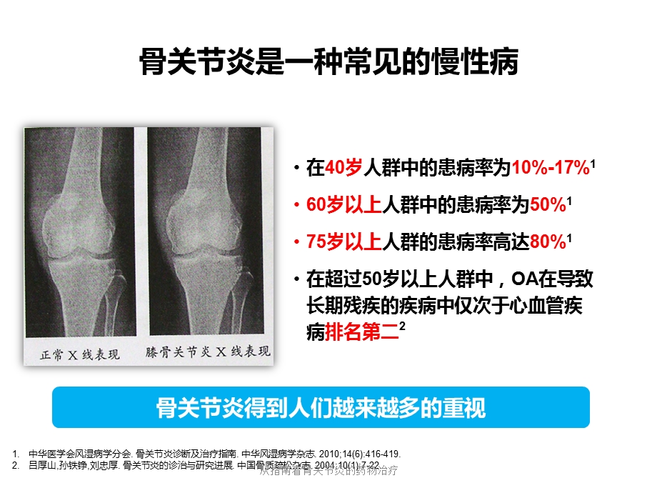 从指南看骨关节炎的药物治疗课件.pptx_第2页