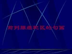 前列腺癌靶区的勾画培训课件.ppt