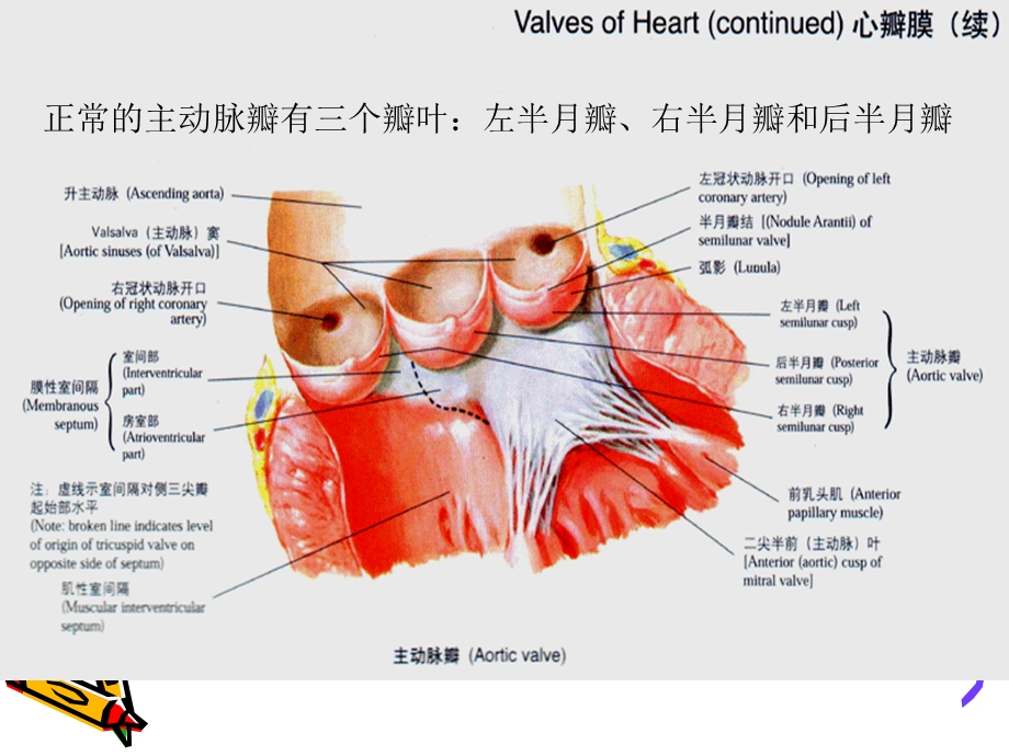 主动脉狭窄护理ppt课件.ppt_第1页