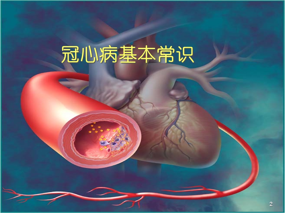 冠心病基本常识及病人的自我保健1课件.pptx_第2页