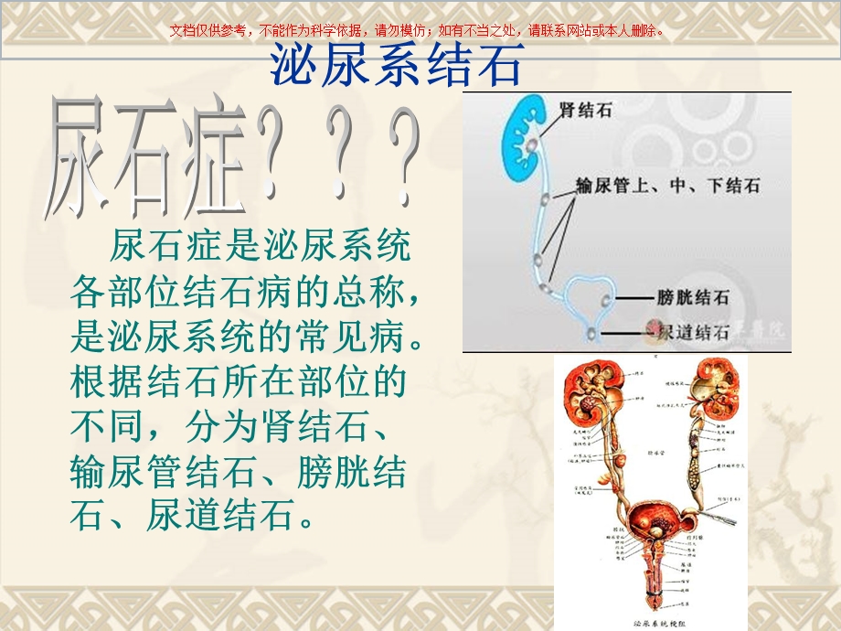 健康教育在泌尿系结石中的应用培训课件.ppt_第3页