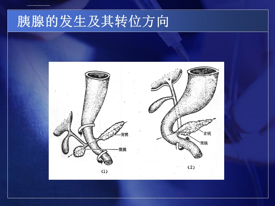 《胰腺炎》PPT课件.ppt_第3页