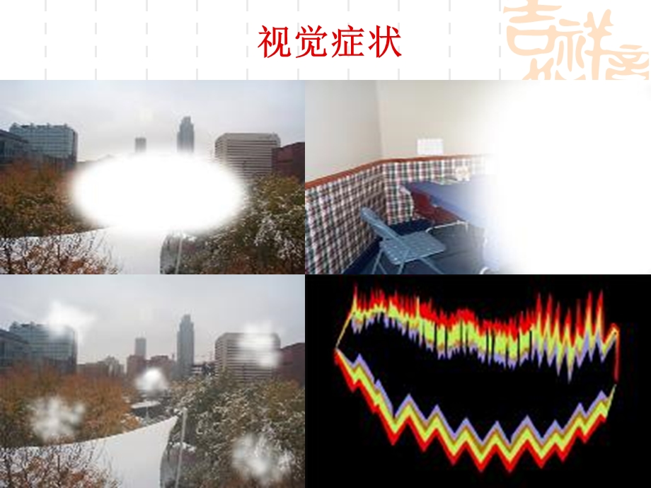 偏头痛医学知识讲座课件.ppt_第3页