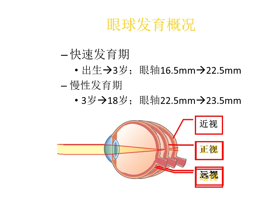 儿童屈光的特点与屈光不正的处理培训课件.ppt_第3页