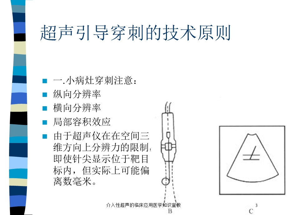 介入性超声的临床应用医学知识宣教培训课件.ppt_第3页