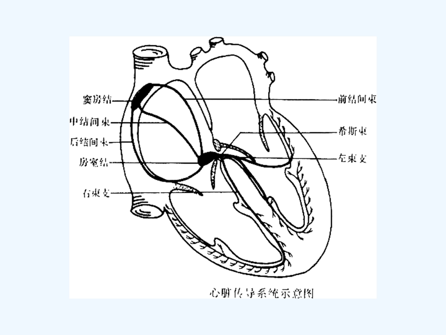 内科学——心律失常一课件.ppt_第3页