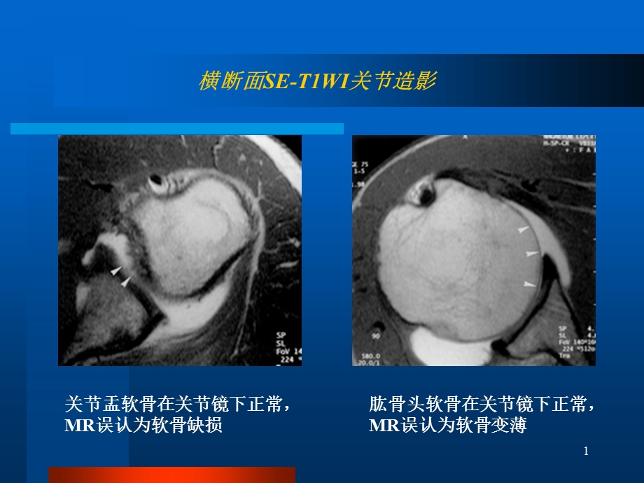 关节软骨课件.ppt_第1页