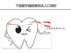 下颌磨牙髓腔解剖及开髓ppt课件.ppt