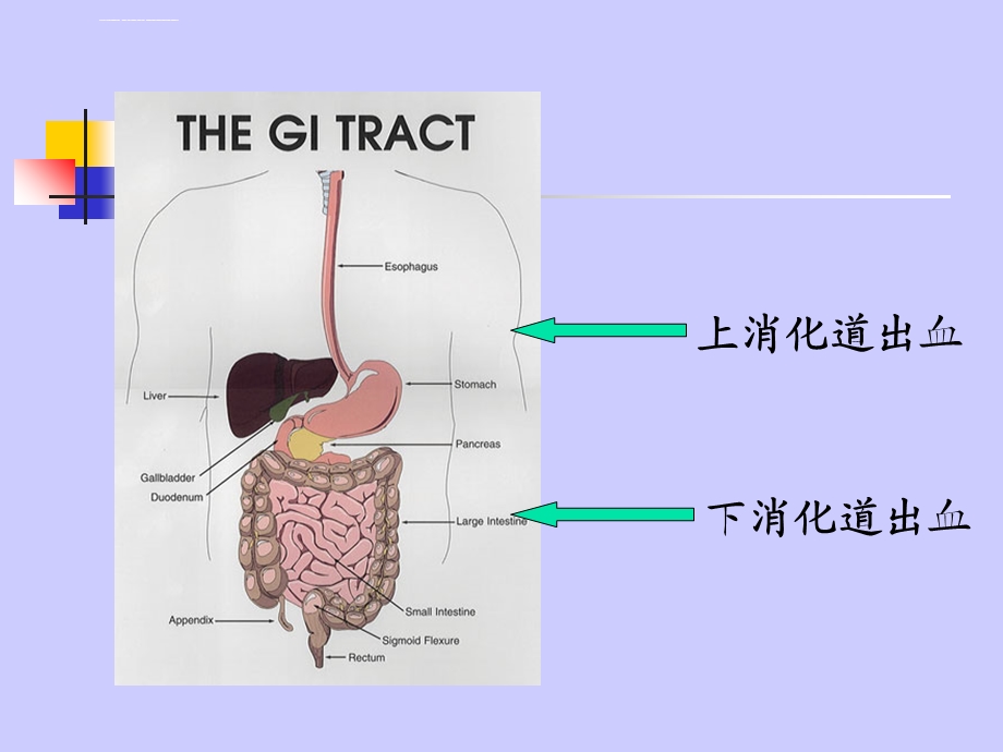 上消化道大出血的护理ppt课件.ppt_第3页