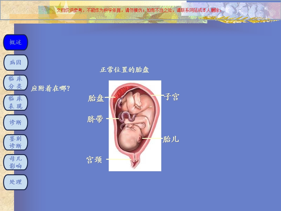 前置胎盘医学知识专题讲座培训课件.ppt_第2页