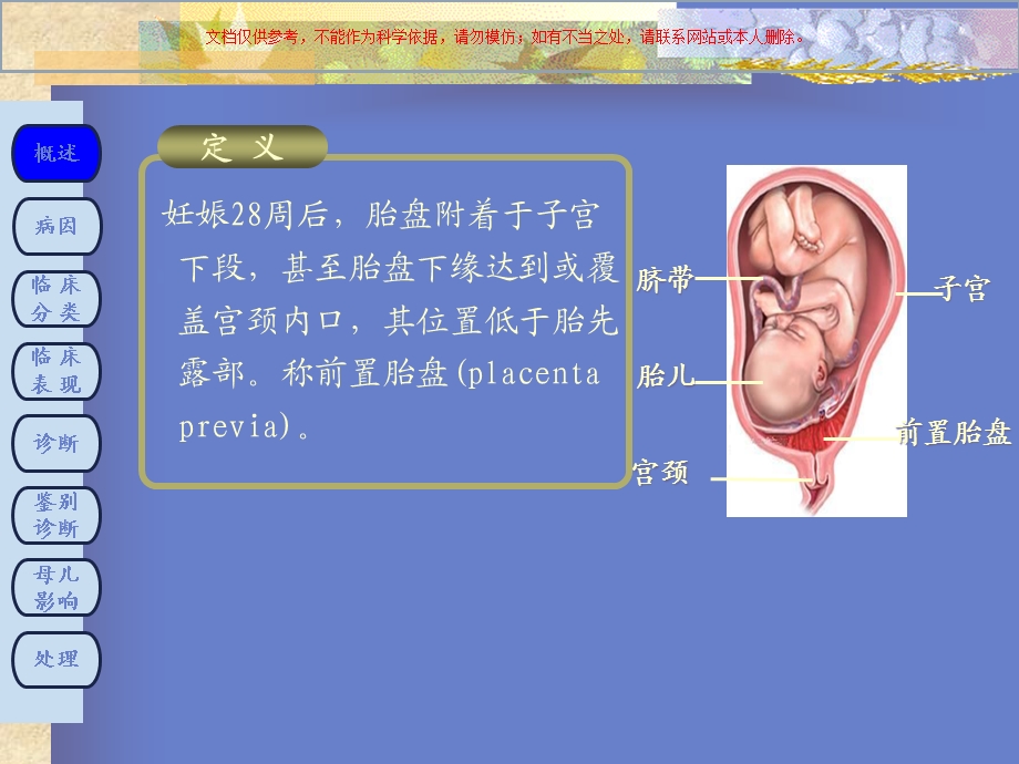 前置胎盘医学知识专题讲座培训课件.ppt_第3页