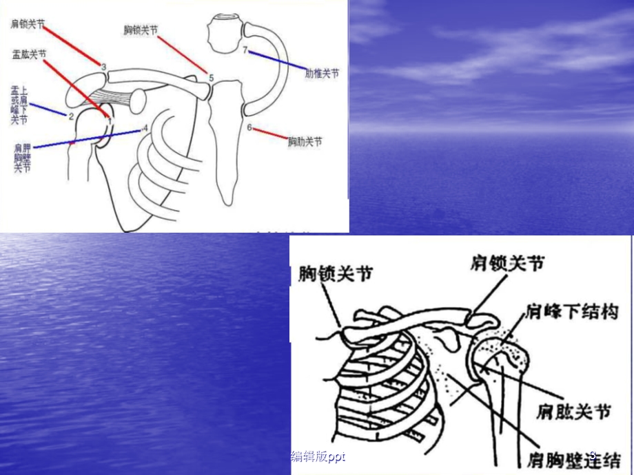 偏瘫患者的常见肩课件.ppt_第3页